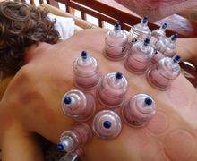 Вакуумный баночный массаж