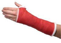 7345830 Tape Cast Delta-Lite Plus Deep Red 2"x4yds 3-5 Min 10Rl/Box Part# 7345830 by BSN Medical, Inc Qty of 1 Box