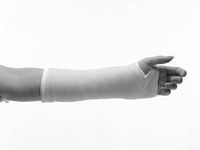 3M Health Care 82001 Plus Casting Tape, Standard, 1" x 2 yd. Size, White (Pack of 10)