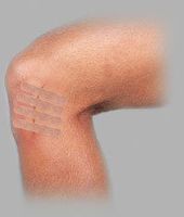 McKesson Skin Closure Flexible Sterile Latex Free 1"X5" - Box of 100 - Model 19-75348