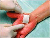 3M Tegaderm Pad Transparent Dressing W/Absorbent 4"X4"Pad 6"X6" Overall - Box of 25 - Model 3588