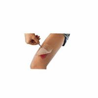 Smith & Nephew Inc 5466045502 Cuticerin Gauze Dressing 8 X 16,Smith & Nephew Inc - Box 25 by Smith+Nephew