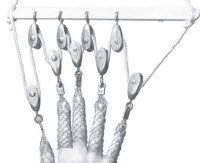 2194772 Finger Traction Apparatus Set 5/St sold as Strip Pt# 00-0325-000-00 by Zimmer, Inc