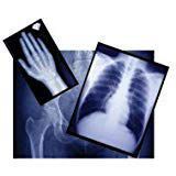 7999698 PT# EZP4F Film X-Ray Radiomat GPlus 15x30cm Half Speed Green 100/Bx Made by Medlink Imaging
