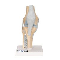 3B Scientific A89 Sectional Knee Joint Model 3-part - 3B Smart Anatomy