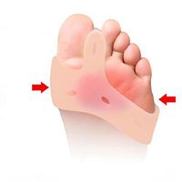 hwangli 1 Pair Toe Shaping Corrector,Breathable Shock-Absorption Hallux Valgus Straightener Orthopedic Pads Skin