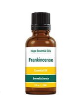 Frankincense Essential Oil