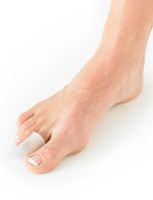 NEO G Silicone Toe Cap - Small - Medical Grade Quality, Premium Quality Silicone Helps Inter Digital Corns, blisters, realign Toes, Hammer/Claw Toes, Friction and Pressure - Unisex