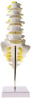 LXX Anatomical Human Spine Model - Anatomical Model Lumbar Vertebrae W/Sacrum Coccyx, with Herniation Disc - Human Skeleton Model for Anatomy Educational Training Aid