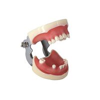 Healifty Teeth Model Dental Implant Practice Model with Soft Gum Dentist for Medical Dental Education Practice Teaching Study
