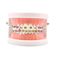 LXX Teeth Model Orthodontic Treatmen Anself Dental Child Teeth Teaching Model Adult Teeth Gums Standard Demonstration Tool Study for Teaching