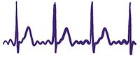 hBARSCI Heartbeat Vinyl Decal - 5 Inches - for Cars, Trucks, Windows, Laptops, Tablets, Outdoor-Grade 2.5mil Thick Vinyl - Purple