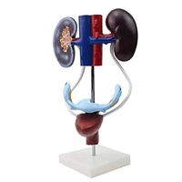 LXX Medical Anatomical Female Genitourinary System Model,Human Kidney Uterine Bladder Anatomy Hand Painted PVC Material for Medical Educational Training Aid, Science Kits, Lab Supplies