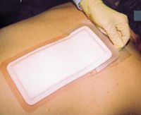 ALLEVYN Plus Adhesive Hydrocellular Dressing 7" x 7" Part No. 66000806 Qty Per Box