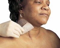 Mepiform Self-Adherent Silicone Dressing. Dimensions: 2" x 3" (5 x 7.5 cm), Qty.: 1 box o