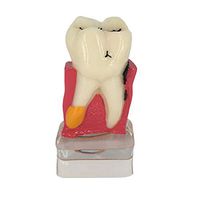 Healifty Dental Demonstration Model Dental Teeth Model Comprehensive Periodontal Pathological Disease Model for Medical Science Study Teaching Communication