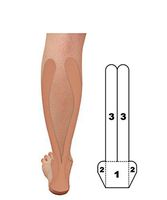 Kindmax Precut Application 5 Pack