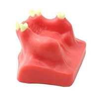 LXX Dental Adult Teeth Model - Maxillary Sinus Lifting Operation Model Dental Department for Medical Teaching Model