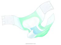 Wings Bariatric Adult Brief [WINGS BARIATRIC ADL BRF]