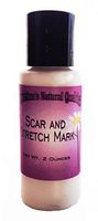 Scar & Stretch Marks All Natural Lotion with Tamanu and Essential Oils