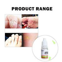 Skin Tag Remover Skin Tag Mole Genital Wart Remove, Skin Tag Removal Medical Tu Kill Remover, Remove Genital Warts, Moles, Skin Tags, Not Cause Pain, Effective, Fast, No Side Effects 1PC
