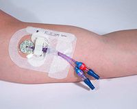 Clik-FIX PICC/Central Catheter Securement (Foam)