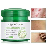Psoriasis Creams,Psoriasis Treatment,Psoriasis Creams for Dermatitis, Eczema, Chinese Herbal Cream Pruritus Psoriasis Ointment