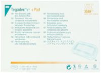 3M Tegaderm +Pad Film Dressing with Non-Adherent Pad 3589, 100 Pieces (Pack of 4)