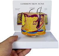 LXX Skin Anatomy Model - Hair Follicle Hair Anatomy Model Acne Pustule Blackhead Medical Teaching Model - for Science Classroom Study Display,Medical Training Aid
