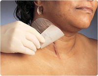 Mepiform Self-Adherent Silicone Dressing. Dimensions: 4" x 7" (10 x 18 cm), Qty.: 5/box