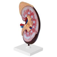 LXX Human Kidney Model,Medical Anatomical Educational Model Environmentally Friendly PVC Material for School Teaching Display Lab Supplies