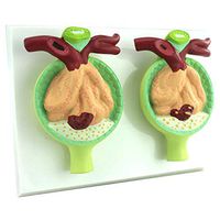 LXX Anatomical Human Proteinuria Model - Renal Nephrology Urology Internal Medicine - Zoom in 300 Times - Teaching and Learning Aids, Science Kits, Lab Supplies