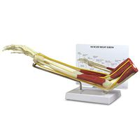 Elbow Joint w/Muscles Model | Human Body Anatomy Replica of Normal Muscled Elbow Joint for Doctors Office Educational Tool | GPI Anatomicals