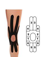 5 Pack - Kindmax Kinesiology Tape Precut Knee Support (Black) - K Tape for Knee Pain