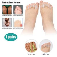 Gel Toe Separators Toe Stretchers, Hammer Toe Spacer for Hallux Valgus Aid Splint, Bunion Corrector for Quickly Alleviating Pain After Yoga and Sports Activities,White