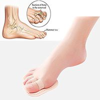 Hammer Toe Straightener Overlapping Toes Bunion and Toe Big Little Thumb Separator