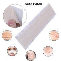 Scar Medical Silicone Gel Sheet Removal Away Cesarean Section Patch Wound Marks