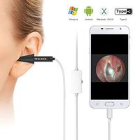 Teslong Mini Otoscope USB Ear Otoscope Inspection Camera with 6 LED Lights for Android Samsung LG Sony Smartphones Mac and PC