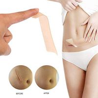 Reddhoon Silicone Scar Sheets for Scar Removal, Recovery Scar Treatment Sheet, Fast & Effective on Surgery, Burn, Acne, C-section, Reusable Washable Scar Gel Silicone Tape - Skin Tone