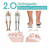 2019 Orthopedic Bunion Corrector 2.0 Toe Separators Elastic Straighteners Spacers (1 Pair) (White)