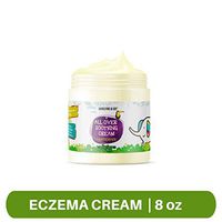 Unscented All Over Soothing Baby Cream for Eczema| Natural Healing Cream for Baby Eczema, Cradle Cap (Infant Seborrheic Dermatitis), Chapped Nose, Rashes| Made in The U.S.A (8 oz)