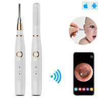 flydragonsuper Smart Ear Spoon 720P Million Hd,Ear Canal Endoscope with 6 LED Lights,Otoscope with 12 Replacement Heads Included,Suitable for Windows,Apple Computer and All Smartphone Tablets-3.9mm