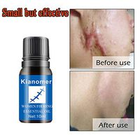 Scar Repair Oil, Scar Removal Oil, Scar Repair Essence, Reduce Acne Scars, Stretch Marks, Scar Removal Essential Oil for Face Acne Scar Spots Stretch Mark Treatment, By Zhengpin