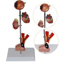 LXX Removable Human Diabetes Organ Model Pathology Classroom Professional Model Lab Equipment Ornament Science Toy