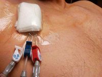 PICC Moisure Barrier for Shower - Transparent Film Wound Dressing Protection Cover, 7 x 7 Inch (7 Pcs)