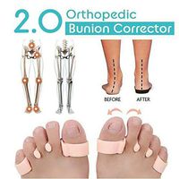 Orthopedic Bunion Corrector Toe Separators Elastic Straighteners Spacers 2.0