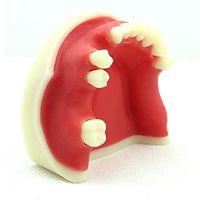 LXX Teeth Model for Education,Dental Adult Mandibular Missing Tooth Model Dental Department for Medical Teaching Model Standard Demonstration Tool