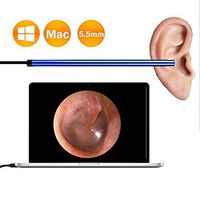 Otoscope Ear Cleaning Integrated 5.5mm Ear Pick Tool Visual Ear Spoon Camera Endoscope