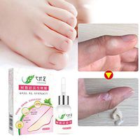 Warts Removal Ointment, Zhengpin Foot and Hand Care From Ancient Chinese Medicine Formula (A)