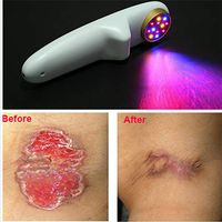 ATANG New Medical Cold Laser Dental Therapy/Pain/Inflammation/Arthritis Light Therapy Pain Gone Cervical Spondylosisb